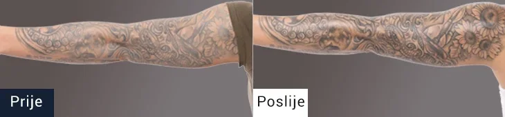 Koža pred in po uporabi mazila za nego tetovaže TATTOO NANO SHOCK