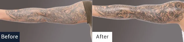 Skin before and after the use of TATTOO NANO SHOCK