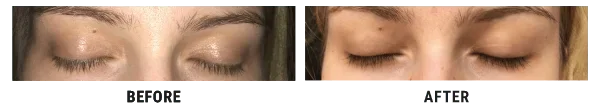 Ivona Pavić before and after using Lux-Factor EYELASH serum