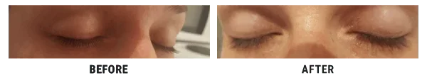 Mojca Bahun before and after eyelash picture